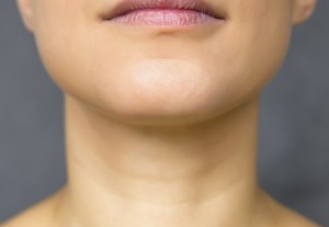 Image of a woman's neck
