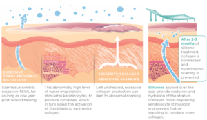 Silagen by Newmedical Technology